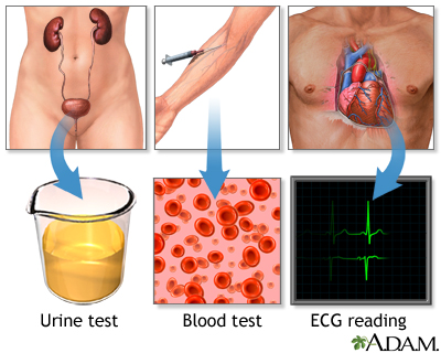 High blood pressure tests - Illustration Thumbnail              