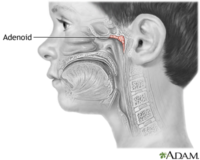 Adenoids Xray