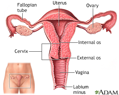 The tissue from Case 1, open and showing blood clots and endometrium