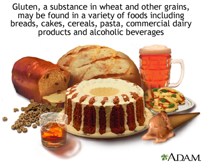 Celiac sprue - foods to avoid - Illustration Thumbnail              