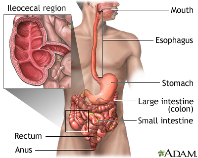 Crohn disease - affected areas - Illustration Thumbnail
              