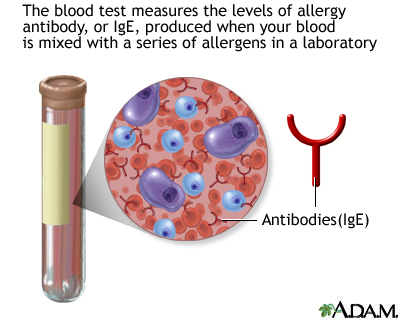 food allergy blood test near me