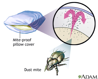 Dust mite-proof pillow cover - Illustration Thumbnail
              
