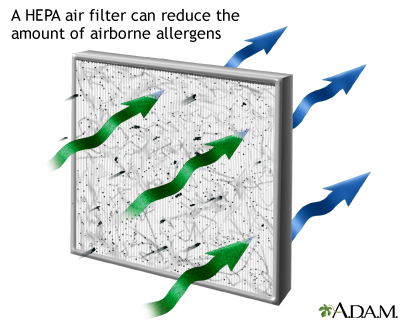 HEPA air filter - Illustration Thumbnail              