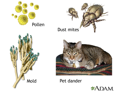 Common asthma triggers - Illustration Thumbnail
              