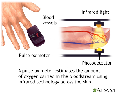 Pulse oximeter