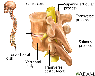 Non-traumatic spinal cord compression and driving