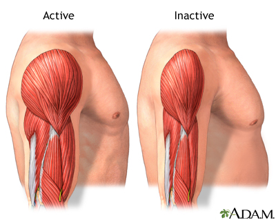 Active vs. inactive muscle - Illustration Thumbnail							