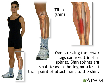 Little Muscle Woman Inside Leg Diagram