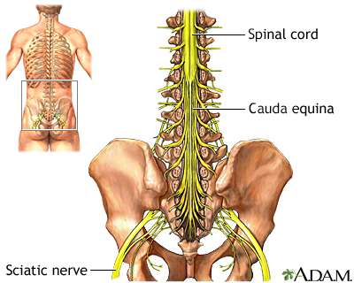 Cauda equina - Illustration Thumbnail
                      