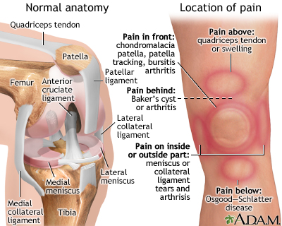 Knee pain - Illustration Thumbnail
              