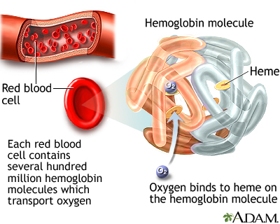 anemia patient