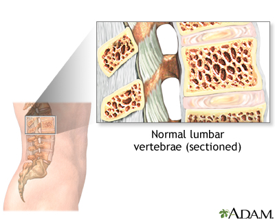 Vertebroplasty - series - Presentation Thumbnail
              