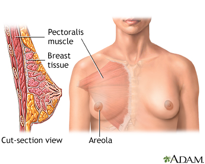 Breast augmentation - series - Normal anatomy