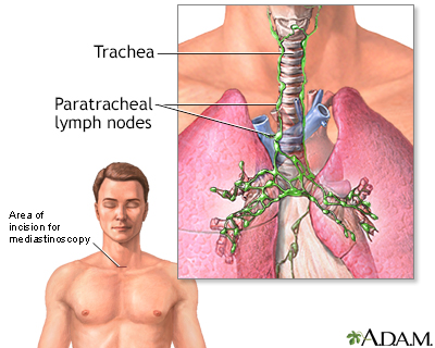 Mediastinum - Illustration Thumbnail
                      