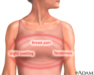 breast pain before 10 days of periods