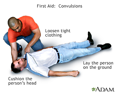 Convulsions - first aid - series