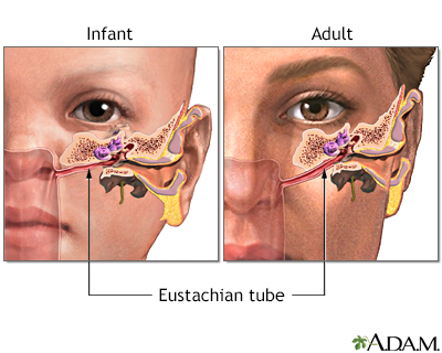 Ear Infection Middle Ear Otitis Media Symptoms and Causes