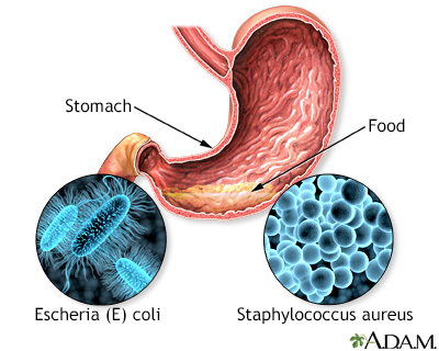 Food poisoning pain 2025 in right side