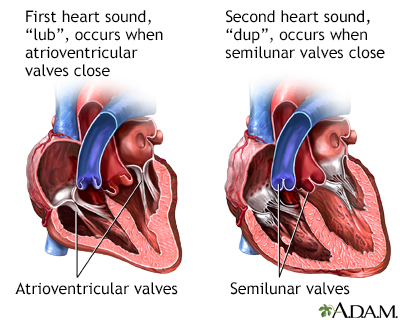 Heart palpitations Information