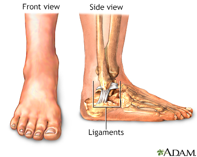 Low ankle sprains versus High ankle sprains: Orthopedic Center for Sports  Medicine: Sports Medicine Physicians