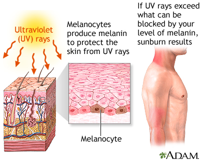 Ultraviolet (UV) protection