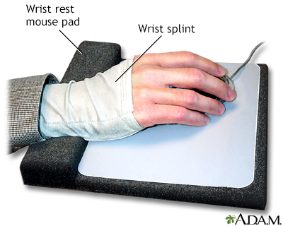 Wrist splint