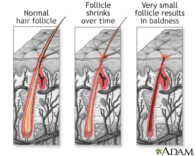 Hair follicle - Illustration Thumbnail
                      