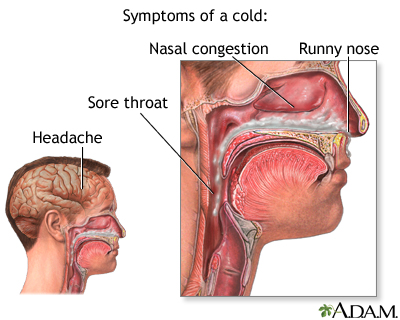 Cold symptoms