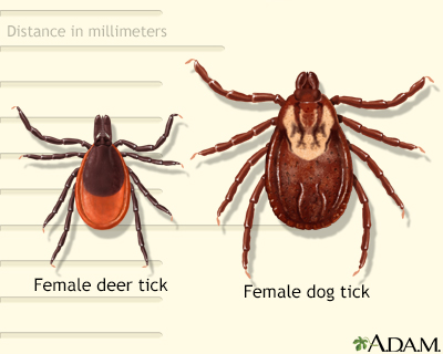 how do you remove an embedded tick from a dog