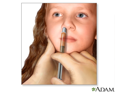 Nasal spray flu vaccine - Illustration Thumbnail
              