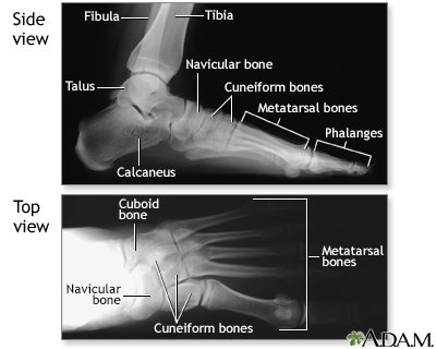 Normal foot X-ray - Illustration Thumbnail
                      