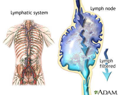 What Do Swollen Lymph Nodes in the Groin Mean?