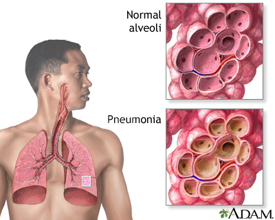 Coronavirus Information