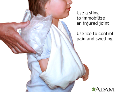 Triangular shoulder sling - Illustration Thumbnail
              