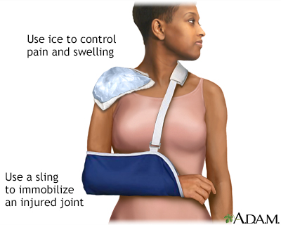 Shoulder sling - Illustration Thumbnail
                      