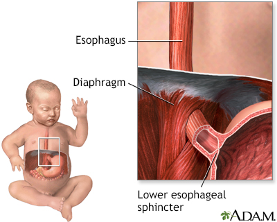 Baby spitting up - Illustration Thumbnail
                      