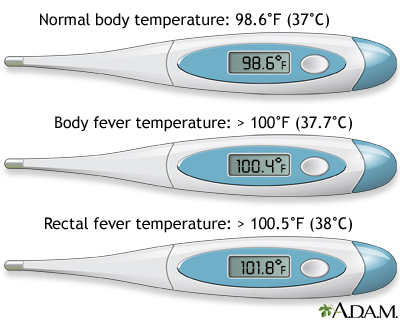 Think your normal temperature is 98.6? Maybe not (and why that's