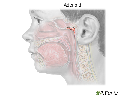 adenoid auditory tube