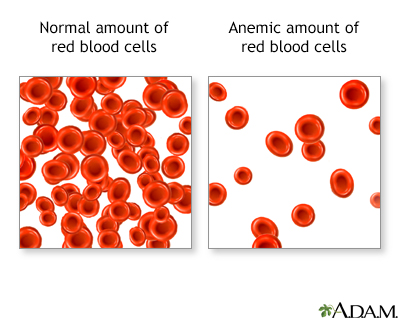 Red Blood Cells and Anemia