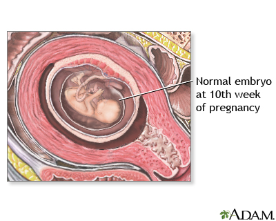 10 Week Old Embryo