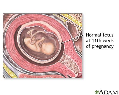 Week 11 of Your Pregnancy