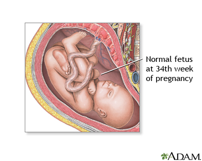 34 Week Old Fetus