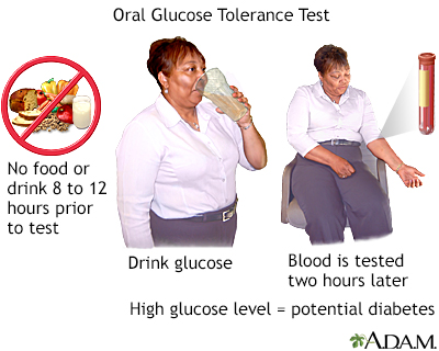 Oral glucose tolerance test - Illustration Thumbnail
              