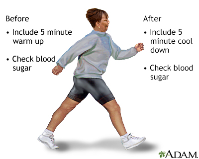 Diabetes and exercise - Illustration Thumbnail
              