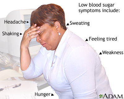 Low blood sugar symptoms - Illustration Thumbnail              