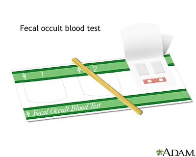 Fecal occult blood test - Illustration Thumbnail
              