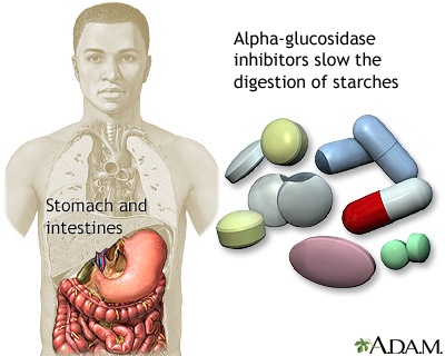 Alpha-glucosidase inhibitors - Illustration Thumbnail
              