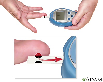Monitoring blood glucose - Calculate glucose level