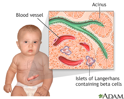 Hyperglycemia in children